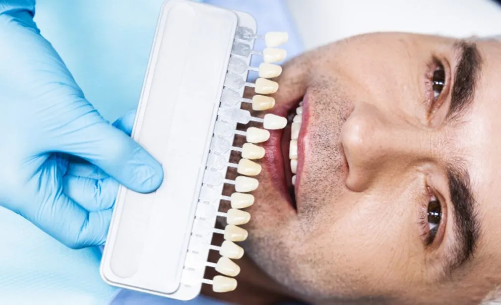 Dental Implants in Dubai