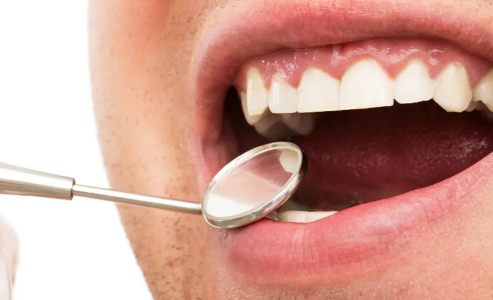Gum treatment in Dubai