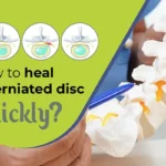 heal a herniated disc quickly
