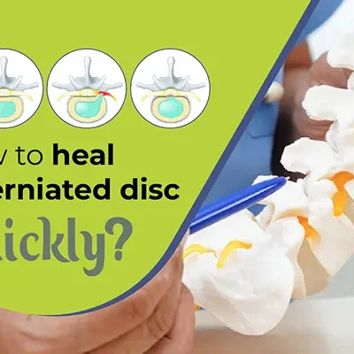 heal a herniated disc quickly