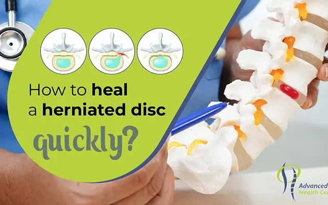 heal a herniated disc quickly