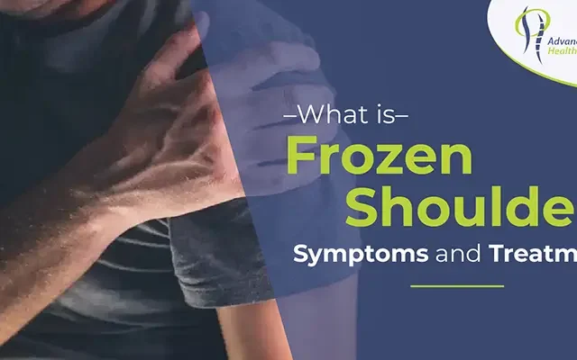 what is frozen shoulder